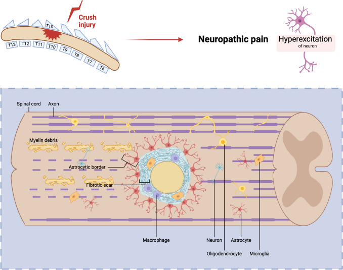 Neuropathic Pain Induced by Spinal Cord Injury from the Glia Perspective and Its Treatment.