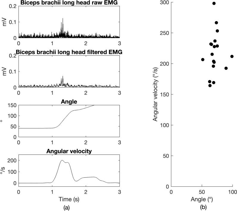 Learning ballet technique modulates the stretch reflex in students with cerebral palsy: case series.
