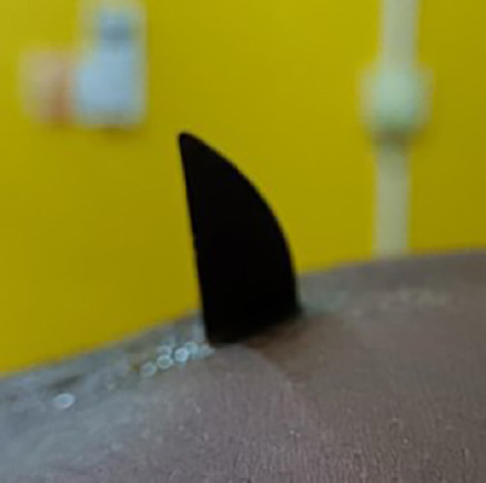 [Abdominal parietal abscess secondary to the absorption of a knife by a mental patient, Treichville University Hospital, Côte d'Ivoire].