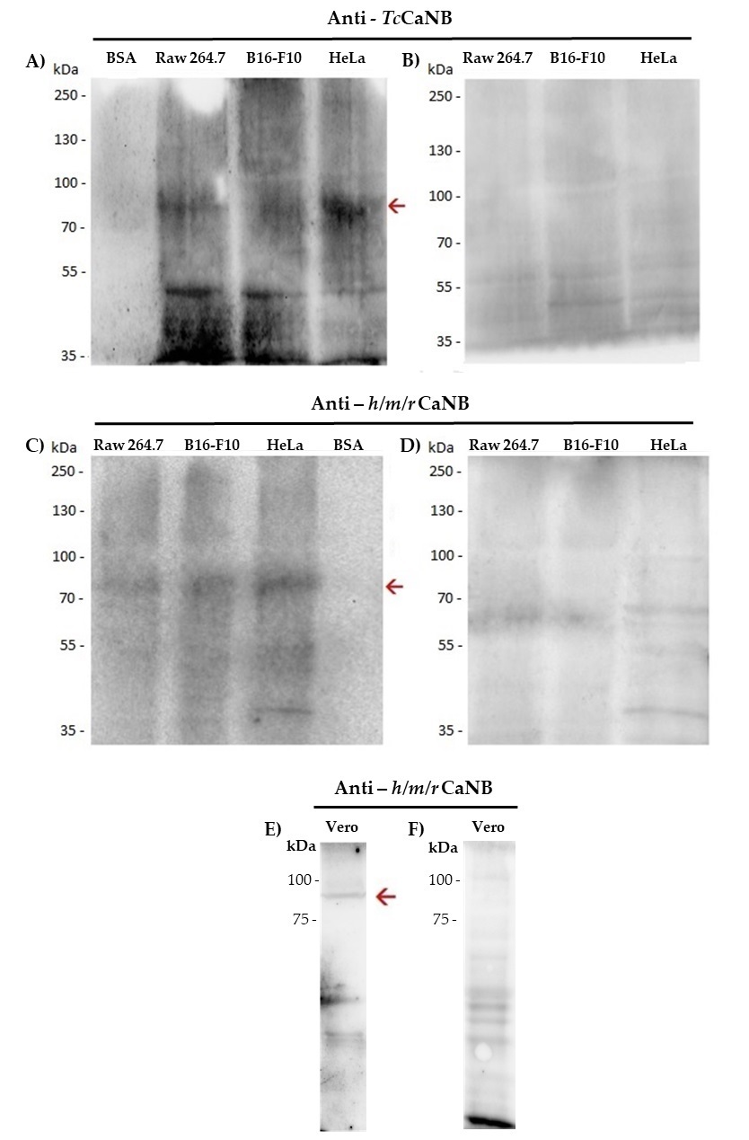 Cytotoxic Effect of <i>Trypanosoma cruzi</i> Calcineurin B Against Melanoma and Adenocarcinoma Cells In Vitro.