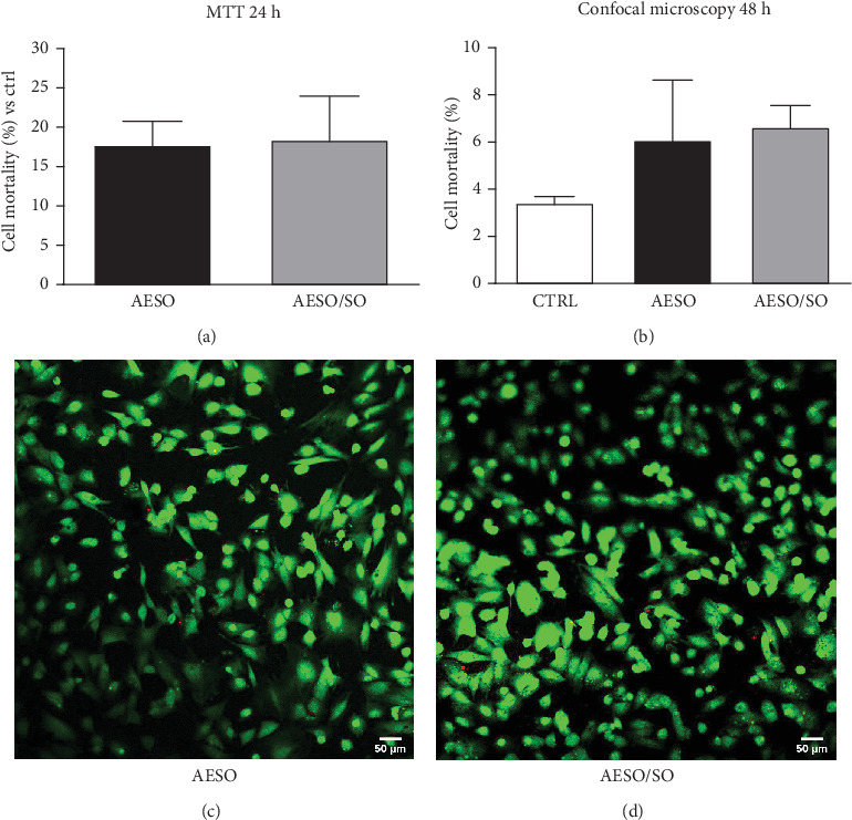 Biodegradation Study of Biomaterials Composed of Acrylated Epoxidized Soybean Oil: An In Vitro Study.