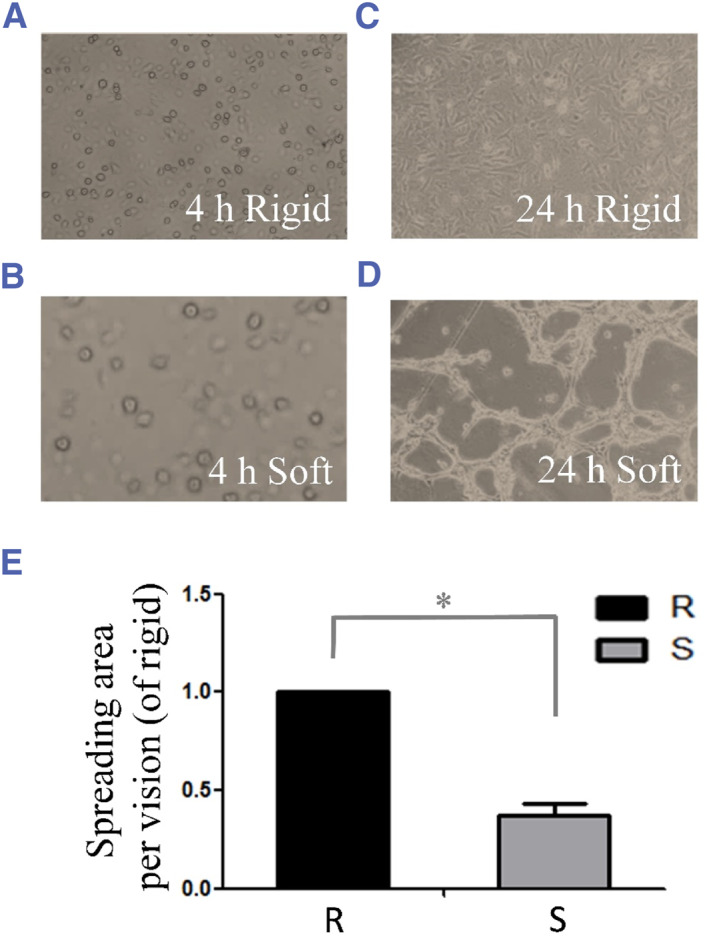 Change in p53 nuclear localization in response to extracellular matrix stiffness.