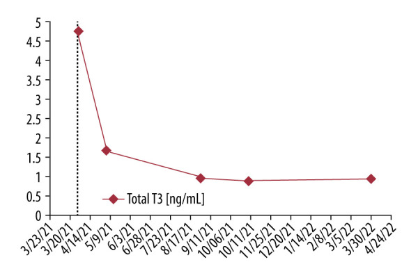 Graves' Disease and Microcytic Anemia: A Forgotten Connection.