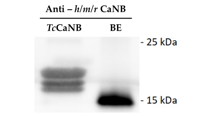 Cytotoxic Effect of <i>Trypanosoma cruzi</i> Calcineurin B Against Melanoma and Adenocarcinoma Cells In Vitro.