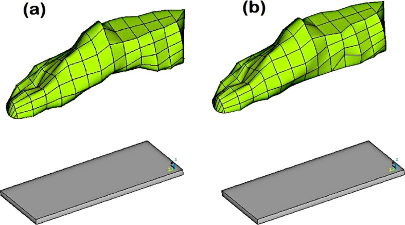 Emerging technologies for the management of diabetic foot ulceration: a review.