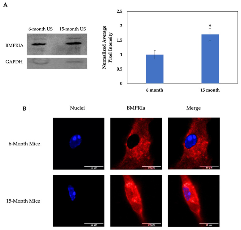Methyl-Beta-Cyclodextrin Restores Aberrant Bone Morphogenetic Protein 2-Signaling in Bone Marrow Stromal Cells Obtained from Aged C57BL/6 Mice.