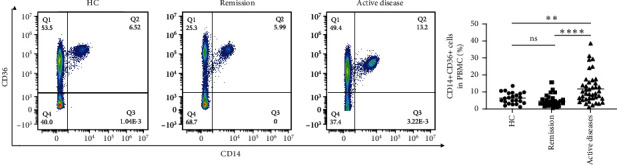 Monocyte CD36 Expression Predicts Disease Activity in Patients With Crohn's Disease.
