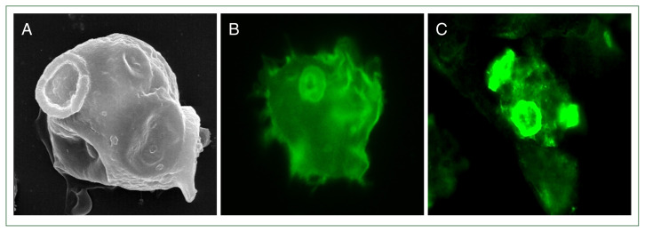 Understanding the pathogenicity of Naegleria fowleri in association with N. fowleri antigen-1 (Nfa1).