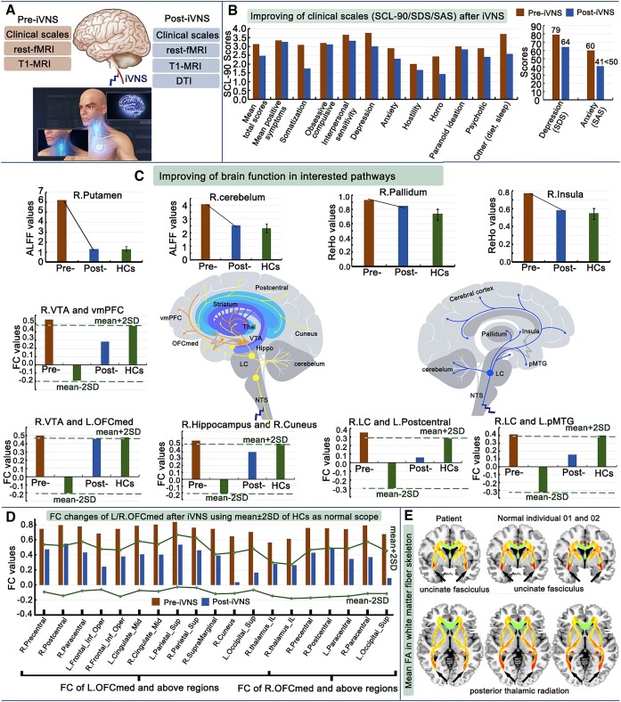 Effectiveness and possible brain mechanisms of cervical invasive vagus nerve stimulation (iVNS) intervention for avoidant/restrictive food intake disorder: a case report.