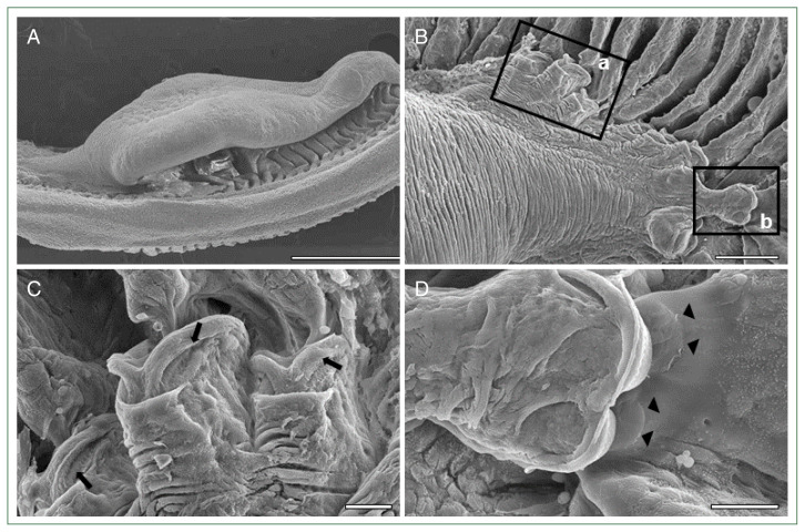 Microscopic findings of host-parasite interaction between the Korean rockfish, Sebastes schlegelii, and the monogenean ectoparasite, Microcotyle sebastis.