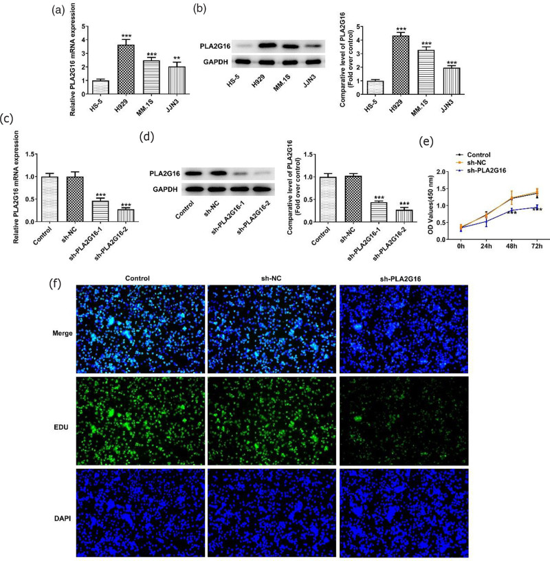 Interference with PLA2G16 promotes cell cycle arrest and apoptosis and inhibits the reprogramming of glucose metabolism in multiple myeloma cells by modulating the Hippo/YAP signaling pathway.