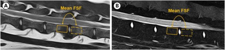 Correlation between fat signal fraction of vertebral body and intervertebral disc degeneration in dogs using magnetic resonance imaging.