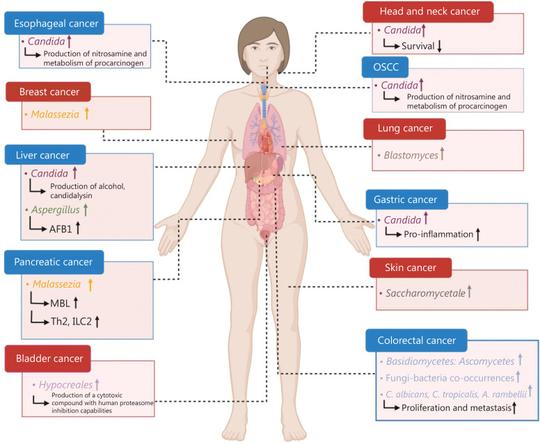 Tumor-related fungi and crosstalk with gut fungi in the tumor microenvironment.