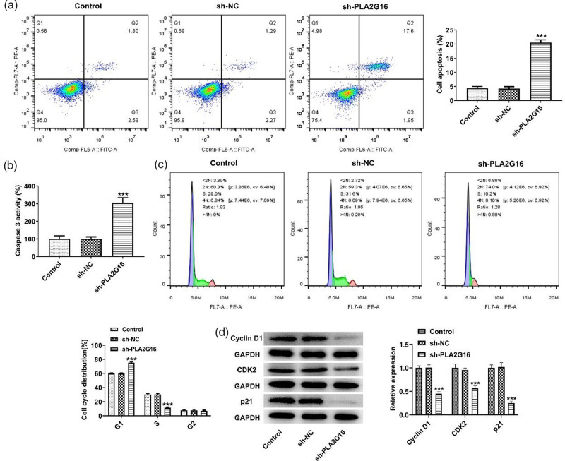 Interference with PLA2G16 promotes cell cycle arrest and apoptosis and inhibits the reprogramming of glucose metabolism in multiple myeloma cells by modulating the Hippo/YAP signaling pathway.
