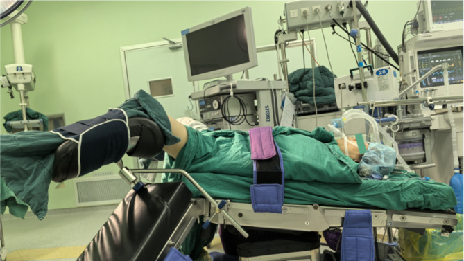 Bilateral lower extremity compartment syndrome after prolonged gynecological surgery in lithotomy position: a case report.