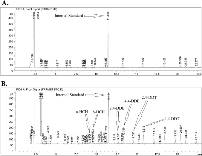 Pesticide Exposure and Its Association with Parkinson's Disease: A Case-Control Analysis.