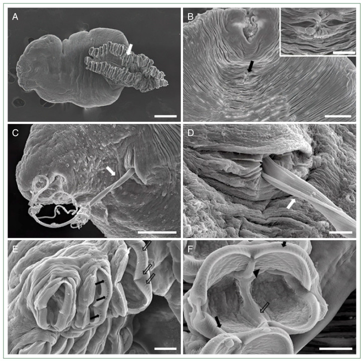 Microscopic findings of host-parasite interaction between the Korean rockfish, Sebastes schlegelii, and the monogenean ectoparasite, Microcotyle sebastis.