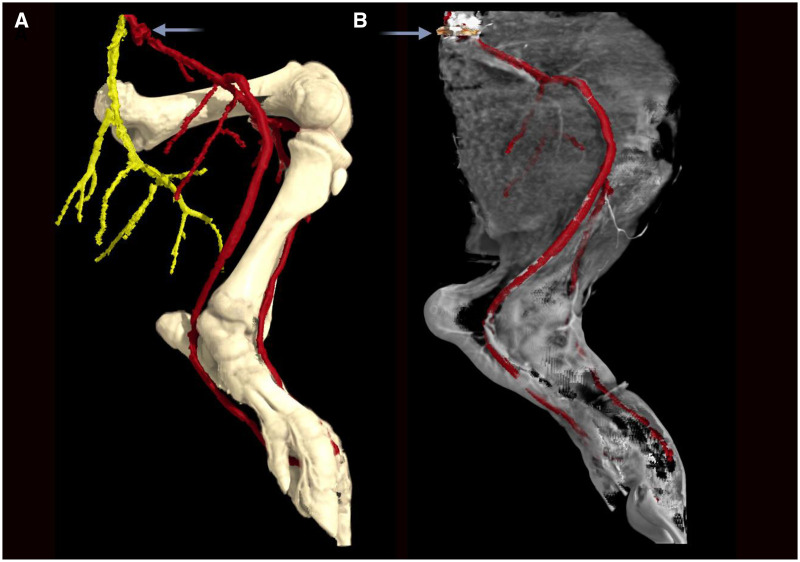 Quantifying lower extremity blood flow using low-dose CT perfusion: validation in a swine model.