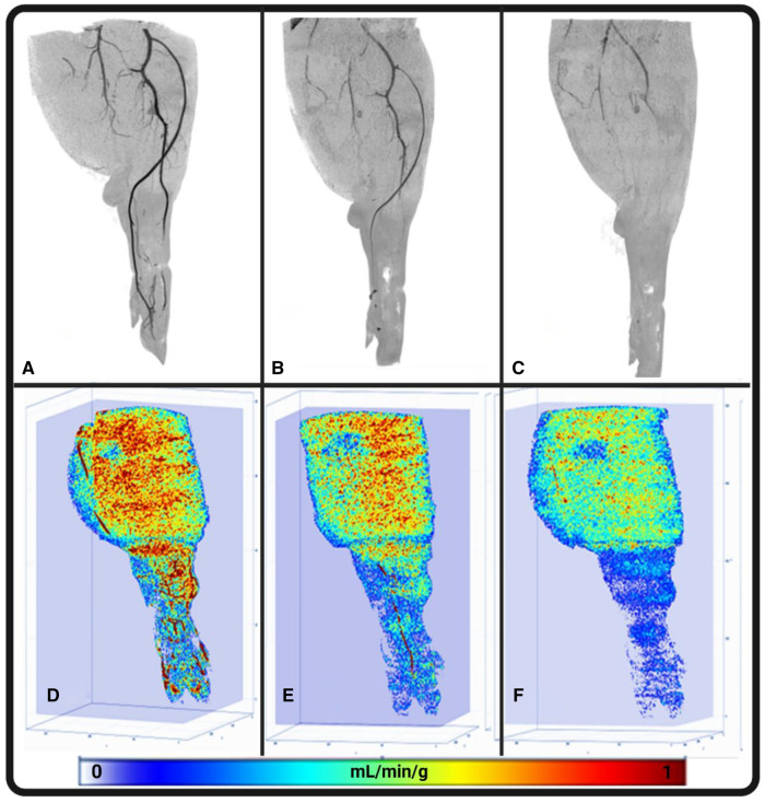 Quantifying lower extremity blood flow using low-dose CT perfusion: validation in a swine model.