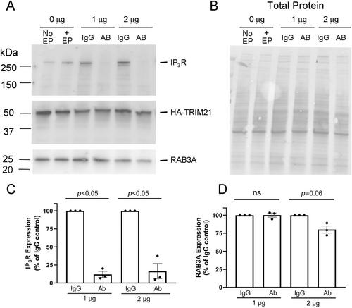 Generation and Characterization of a TRIM21 Overexpressing Mouse Line