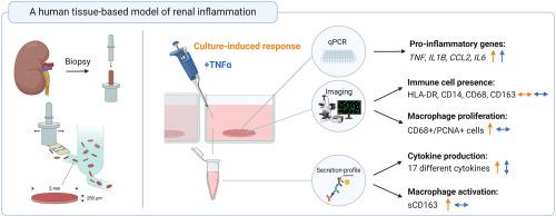 A human tissue-based model of renal inflammation