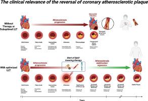 The clinical relevance of the reversal of coronary atherosclerotic plaque