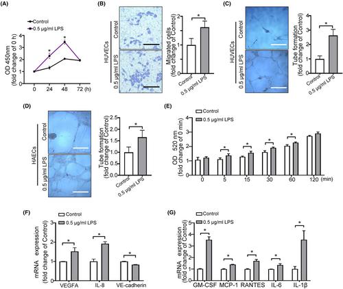 Exosomal miR-155-5p promote the occurrence of carotid atherosclerosis