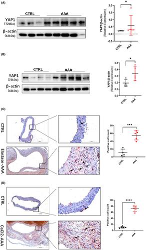 Inhibiting YAP1 reduced abdominal aortic aneurysm formation by suppressing adventitial fibroblast phenotype transformation and migration