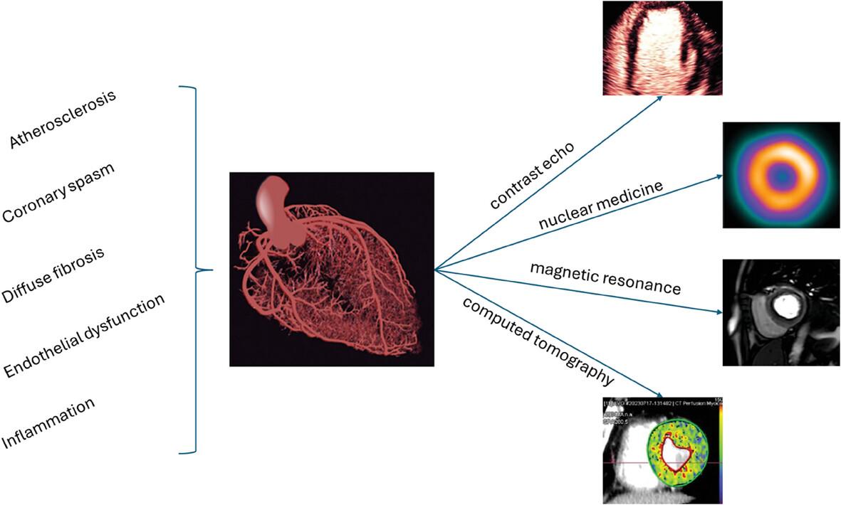 Coronary Microvascular Dysfunction: Searching the Strongest Imaging Modality in Different Scenarios