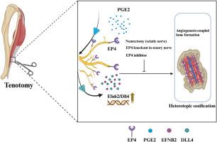 Sensory nerve EP4 facilitates heterotopic ossification by regulating angiogenesis-coupled bone formation