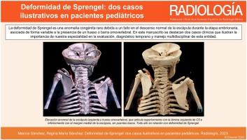 Deformidad de Sprengel: dos casos ilustrativos en pacientes pediátricos