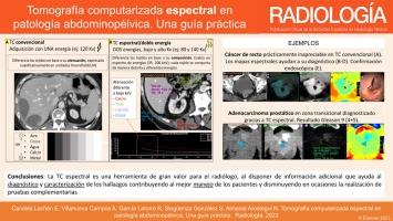 Tomografía computarizada espectral en patología abdominopélvica. Una guía práctica