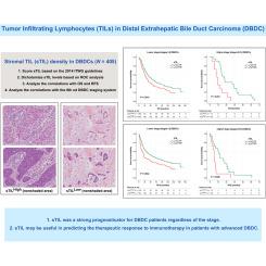 Prognostic value of tumor-infiltrating lymphocytes in distal extrahepatic bile duct carcinoma