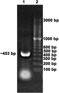 Unraveling the interaction between a glycolytic regulator protein EhPpdk and an anaphase promoting complex protein EhApc10: yeast two hybrid screening, in vitro binding assays and molecular simulation study