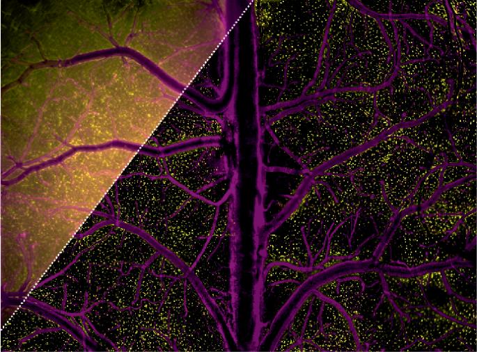 A leap for mesoscale imaging