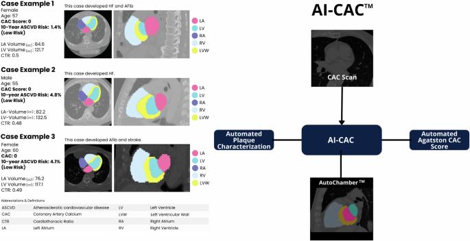 Artificial intelligence applied to coronary artery calcium scans (AI-CAC) significantly improves cardiovascular events prediction