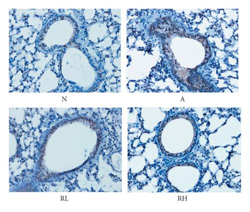 Resveratrol Aerosol Inhalation Attenuates Ovalbumin (OVA)-Induced Asthma in BALB/c Mouse Model