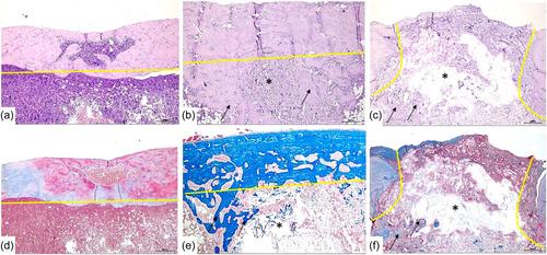 Comparative histomorphological assessment of the osteoinductive capacity of a nanofibrillated cellulose-based composite and autologous blood clot