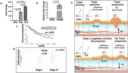 Disabled 2 (Dab2) Regulates Tumour Progression in Skin Squamous Cell Carcinoma