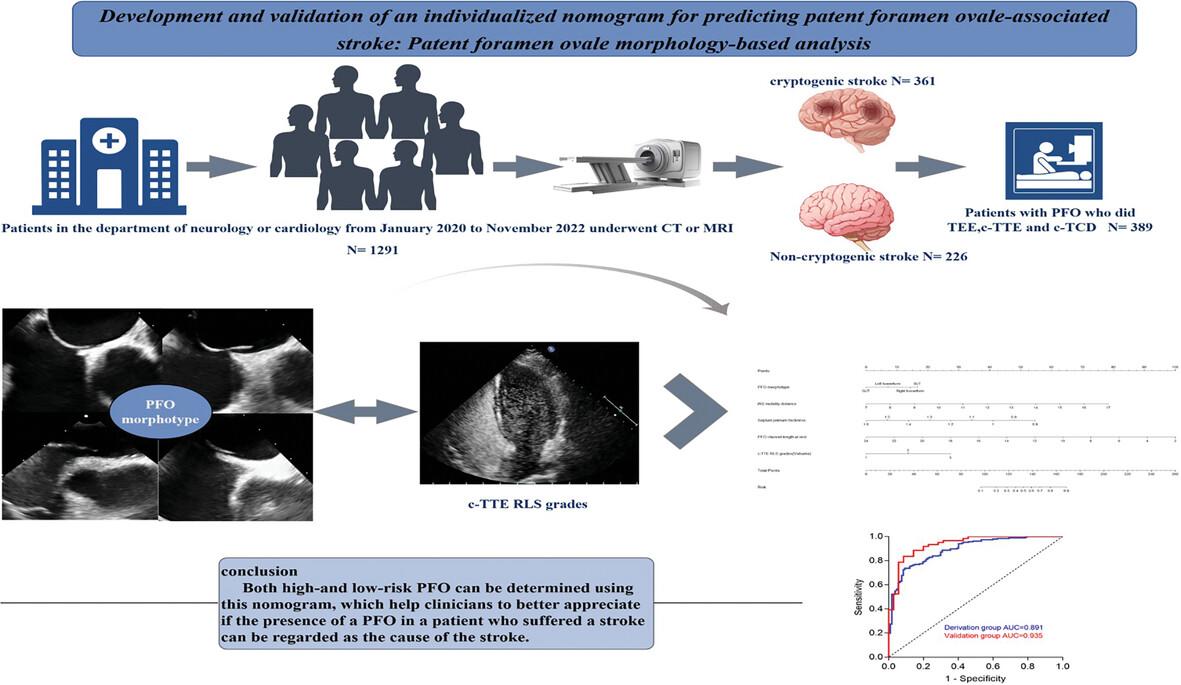 Development and Validation of an Individualized Nomogram for Predicting Patent Foramen Ovale-Associated Stroke: Patent Foramen Ovale Morphology-Based Analysis