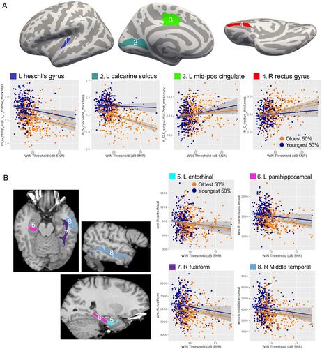 Hearing Function Moderates Age-Related Differences in Brain Morphometry in the HCP Aging Cohort