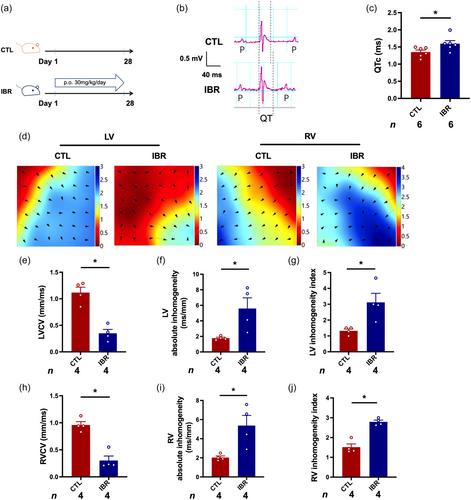 Mitigating ibrutinib-induced ventricular arrhythmia and cardiac dysfunction with metformin