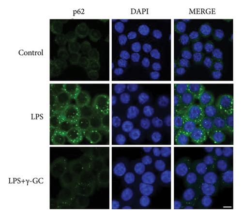 γ-Glutamylcysteine Ameliorates LPS-Induced Inflammatory Responses in BV2 Cells via Activating Autophagy