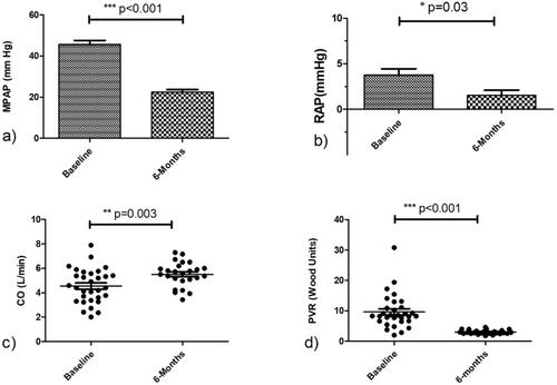 Improvements in Hemodynamics and Right Heart Remodeling Following Balloon Pulmonary Angioplasty Treatment in Patients With Chronic Thromboembolic Pulmonary Hypertension: A Retrospective Study