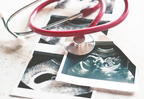 Most young female cancer survivors are at minimal risk for obstetric problems