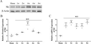 Lentivirus-mediated Knockdown of Ski Improves Neurological Function After Spinal Cord Injury in Rats