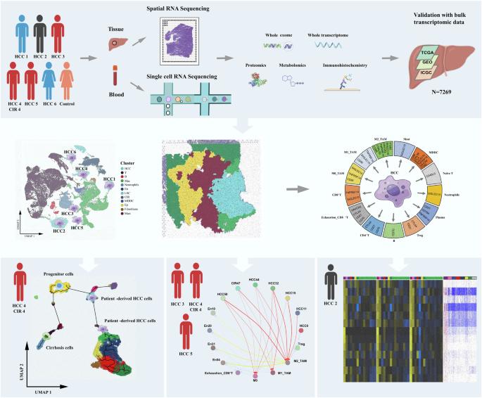 Single cell-spatial transcriptomics and bulk multi-omics analysis of heterogeneity and ecosystems in hepatocellular carcinoma