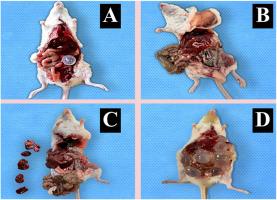 Investigating the therapeutic effects of curcumin nanocapsules in hydatid cyst-infected mice