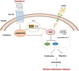 Exendin-4, a glucagon-like peptide-1 receptor agonist, regulates ductus arteriosus by vasodilation and anti-remodeling through the PKA pathway