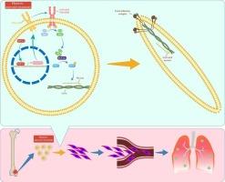 PDGFRB promotes dedifferentiation and pulmonary metastasis through rearrangement of cytoskeleton under hypoxic microenvironment in osteosarcoma